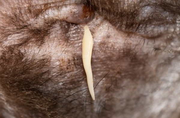 cacingan